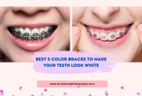 what color makes your teeth look whiter with braces